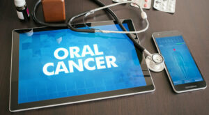 Si svolgerà a Roma e nelle principali piazze italiane Oral Cancer Day 2023, dedicata alla prevenzione del cancro de cavo orale
